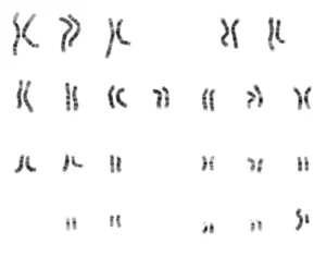 skilky-khromosom-u-liudyny-povnyi-hid-po-kariotypu-01dd